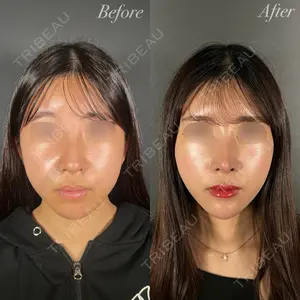 R Beauty CLINIC 大阪院 小池 泰弘医師の症例