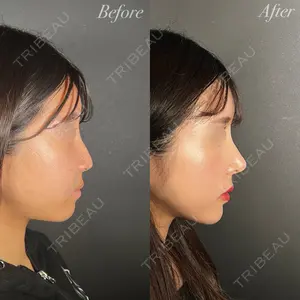 R Beauty CLINIC 大阪院 小池 泰弘医師の症例