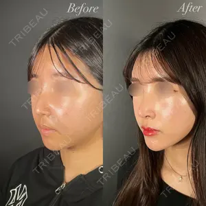 R Beauty CLINIC 大阪院 小池 泰弘医師の症例