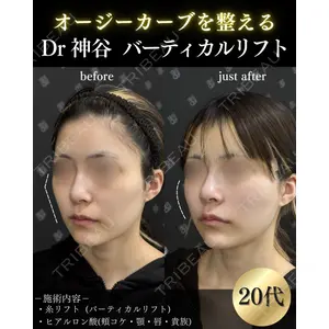 EMMO FACE CLINIC 大阪梅田院 神谷 一成医師の症例