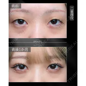 ROOTS Clinic 郭 天元医師の症例
