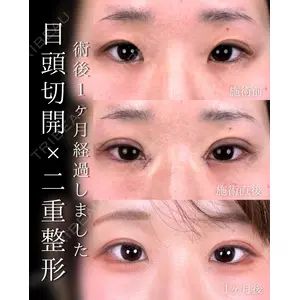 東京シンデレラ美容外科 池袋院 石井 達也医師の症例