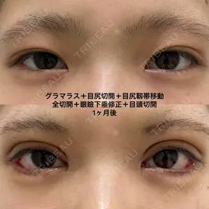 エターナル美容クリニック 久門田 詳医師の症例