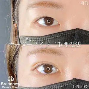 Brandnew Beauty Clinicの症例
