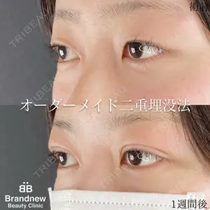 Brandnew Beauty Clinicの症例