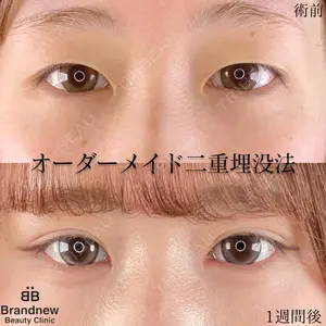 Brandnew Beauty Clinicの症例