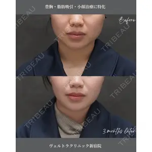 ヴェルトラクリニック 大阪院 西村 秀典医師の症例