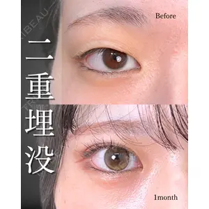 東京シンデレラ美容外科 池袋院 山本 紘子医師の症例