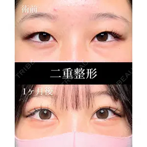 HAAB×DREAM BEAUTY CLINIC 大阪梅田院 鈴木 馨斗医師の症例