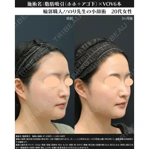 湘南美容クリニック 川崎院 伊藤 賀敏医師の症例