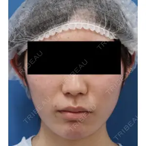 もとび美容外科クリニック 新宿院 西尾 謙三郎医師の症例