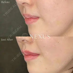 NEXUS CLINICの症例