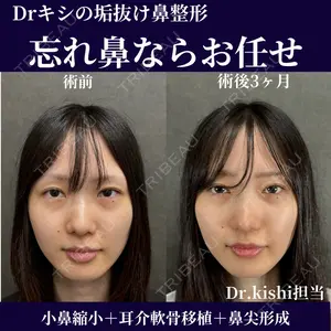 ネビュラクリニック 京都院 岸 大輔医師の症例