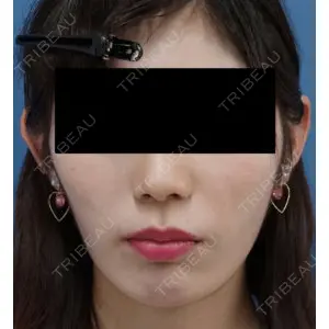 もとび美容外科クリニック 新宿院 西尾 謙三郎医師の症例