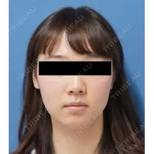 もとび美容外科クリニック 新宿院 西尾 謙三郎医師の症例