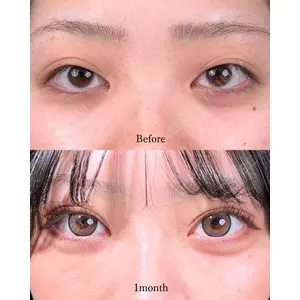 東京シンデレラ美容外科 池袋院 山本 紘子医師の症例