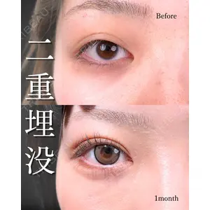 東京シンデレラ美容外科 池袋院 山本 紘子医師の症例