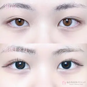 仙台N美容クリニック 小阪 捺稀医師の症例