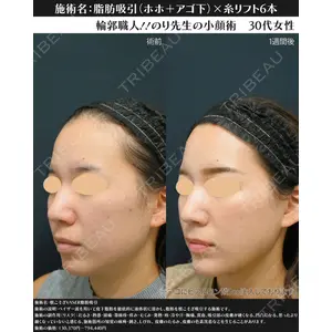 湘南美容クリニック 川崎院 伊藤 賀敏医師の症例