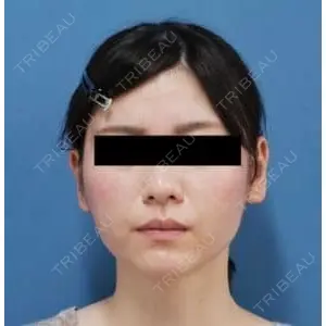 もとび美容外科クリニック 新宿院 西尾 謙三郎医師の症例
