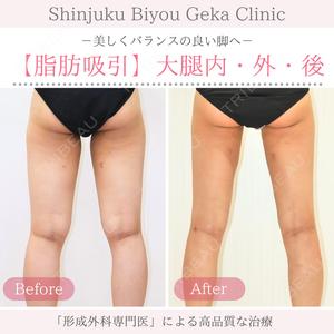 新宿美容外科クリニック 新宿院の症例