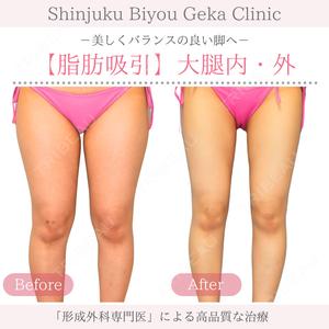 新宿美容外科クリニック 新宿院の症例
