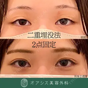 オアシス美容外科 遠藤 剛史医師の症例