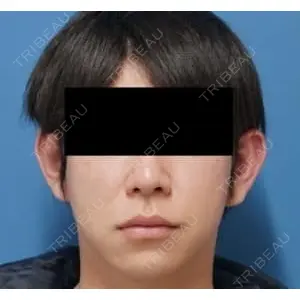 もとび美容外科クリニック 新宿院 西尾 謙三郎医師の症例
