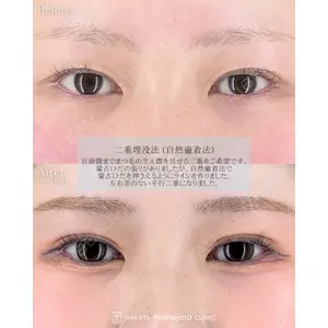 博多もへじのクリニック 村田 将光医師の症例