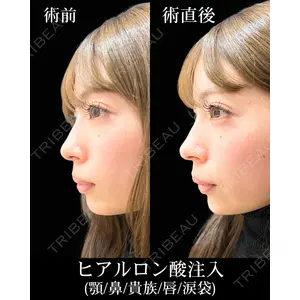 HAAB×DREAM BEAUTY CLINIC 東京本院 佐野 圭医師の症例