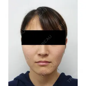もとび美容外科クリニック 新宿院 西尾 謙三郎医師の症例