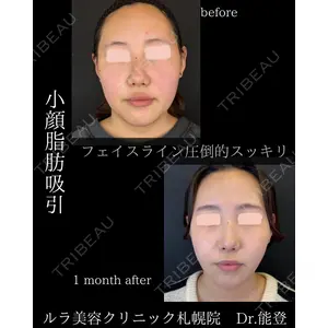ルラ美容クリニック 札幌院 能登 貴弘医師の症例