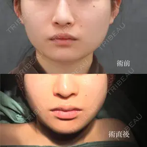 ヴェルトラクリニック 新宿院 伊藤　優医師の症例