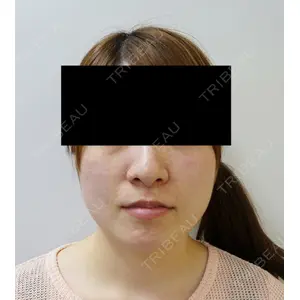 もとび美容外科クリニック 新宿院 西尾 謙三郎医師の症例