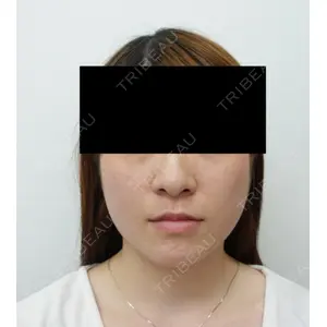 もとび美容外科クリニック 新宿院 西尾 謙三郎医師の症例