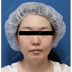 もとび美容外科クリニック 新宿院 西尾 謙三郎医師の症例