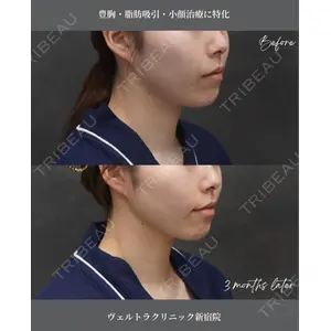 ヴェルトラクリニック 大阪院 西村 秀典医師の症例