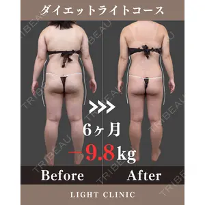 LIGHT CLINIC 【ライトクリニック】 大阪院 吹田　真一医師の症例
