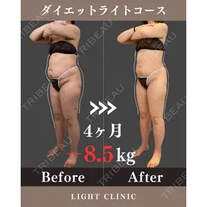 LIGHT CLINIC 【ライトクリニック】 大阪院 吹田　真一医師の症例