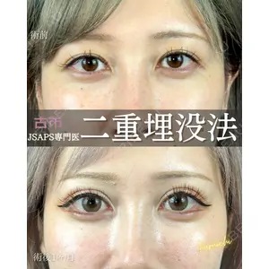 ルラ美容クリニック 新宿院 古市 まり江医師の症例