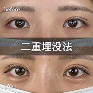 ルラ美容クリニック 新宿院 陶 美梨医師の症例