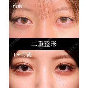 HAAB BEAUTY CLINIC 名古屋院 丸山 舜大医師の症例