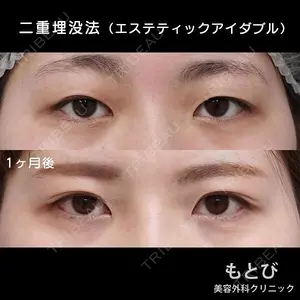 もとび美容外科クリニック 新宿院 西尾 謙三郎医師の症例