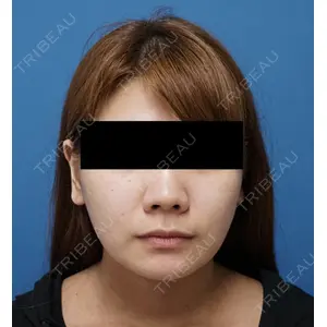 もとび美容外科クリニック 新宿院 西尾 謙三郎医師の症例