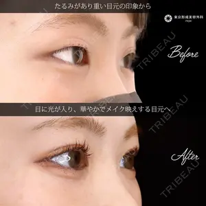 東京形成美容外科 船橋院 弓削田　浩主医師の症例