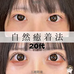 ルラ美容クリニック 札幌院 佐藤 雄紀医師の症例
