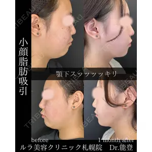ルラ美容クリニック 札幌院 能登 貴弘医師の症例