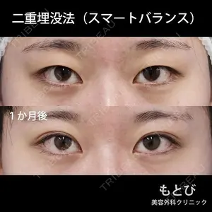 もとび美容外科クリニック 新宿院 西尾 謙三郎医師の症例