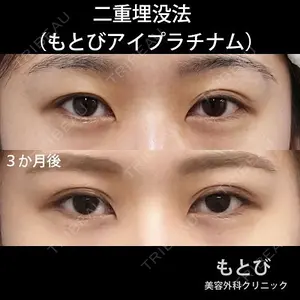 もとび美容外科クリニック 新宿院 西尾 謙三郎医師の症例