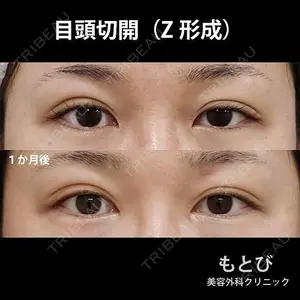 もとび美容外科クリニック 新宿院 西尾 謙三郎医師の症例